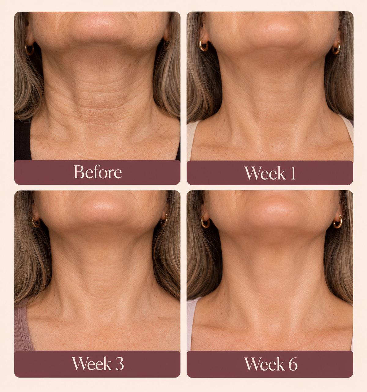 Neck Cream