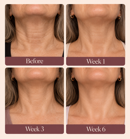 Neck Cream